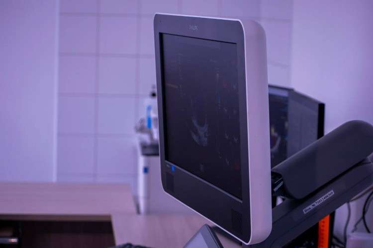 Монитор УЗИ