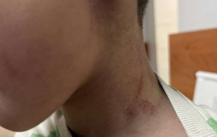 Пострадавший ребёнок