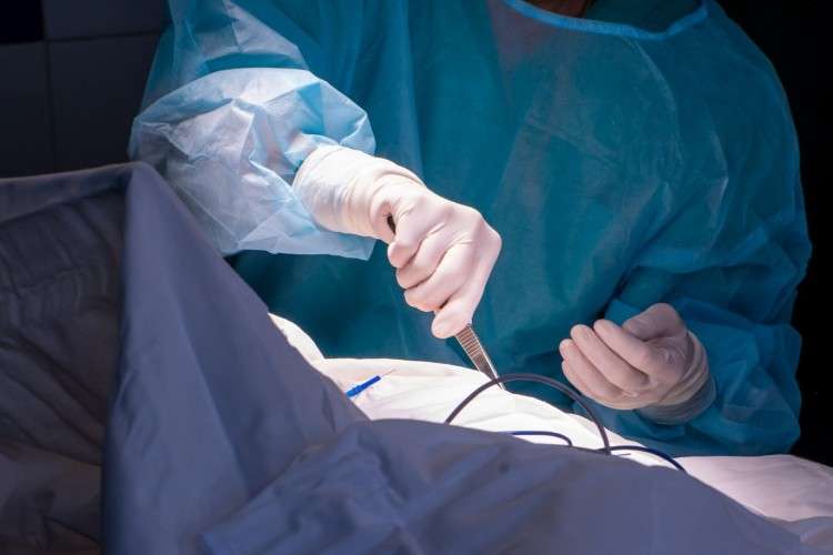 операция, манипуляция, медик, пинцет, перчатки