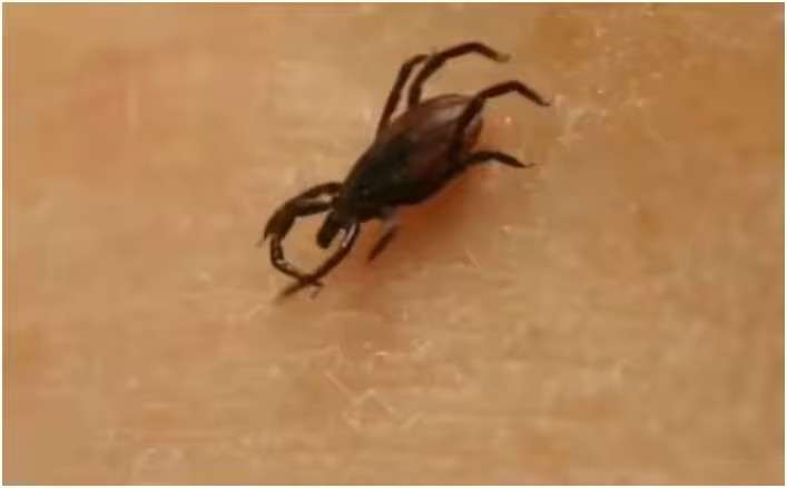 Клещ на коже человека