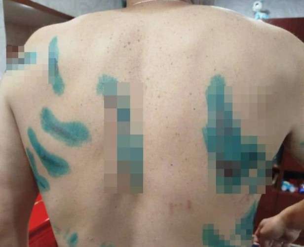 Постадавший