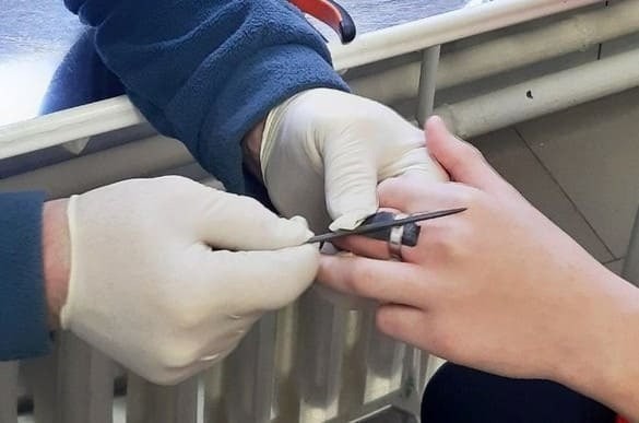 Спасатели в Тайшете помогли девочке снять застрявшее на пальце кольцо