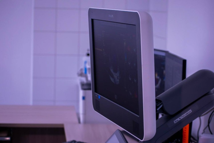 Монитор УЗИ