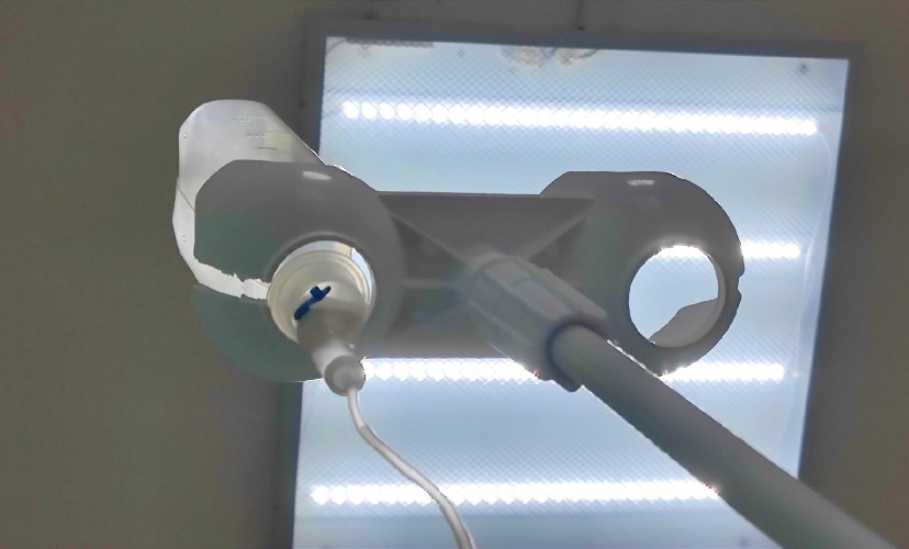 23-летняя жительница Братска оказалась в больнице после ссоры с мужем