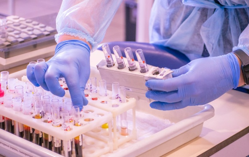 На 14% снизилось число новых случаев ВИЧ в Иркутской области