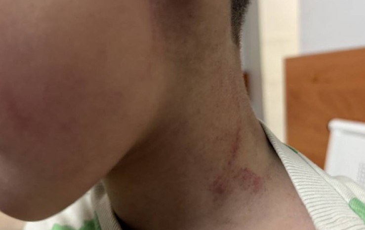 Учитель физкультуры поднял за шею воспитанника детсада под Иркутском