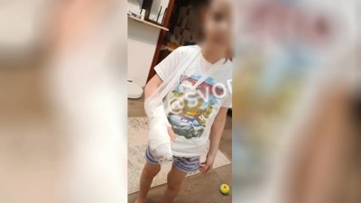 Собаки напали на 6-летнего ребёнка в Иркутске 