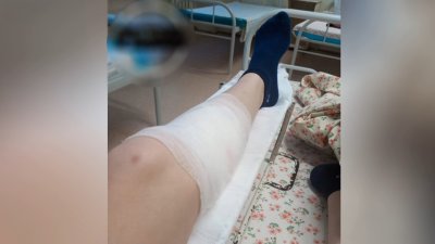 Двое детей пострадали от нападения собак за каникулы в Иркутской области