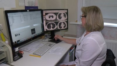 Почти полторы тысячи случаев рака лёгких в год выявляют в Иркутской области