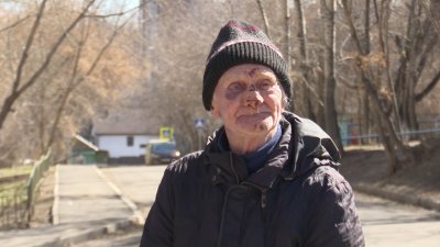 Травмы получил 91-летний иркутянин рядом с домом из-за торчащей арматуры