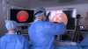 Новый вид операции на позвоночнике учатся проводить иркутские хирурги 